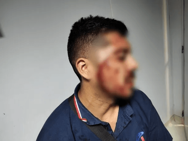 🚨 Paro de colectivos en Virrey del Pino tras brutal ataque a un chofer de la línea 218